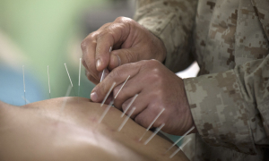 Arthritis Pain